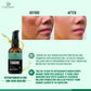 Tamanu Oil - Cold pressed & Organic For face and skin| Therapeutic grade