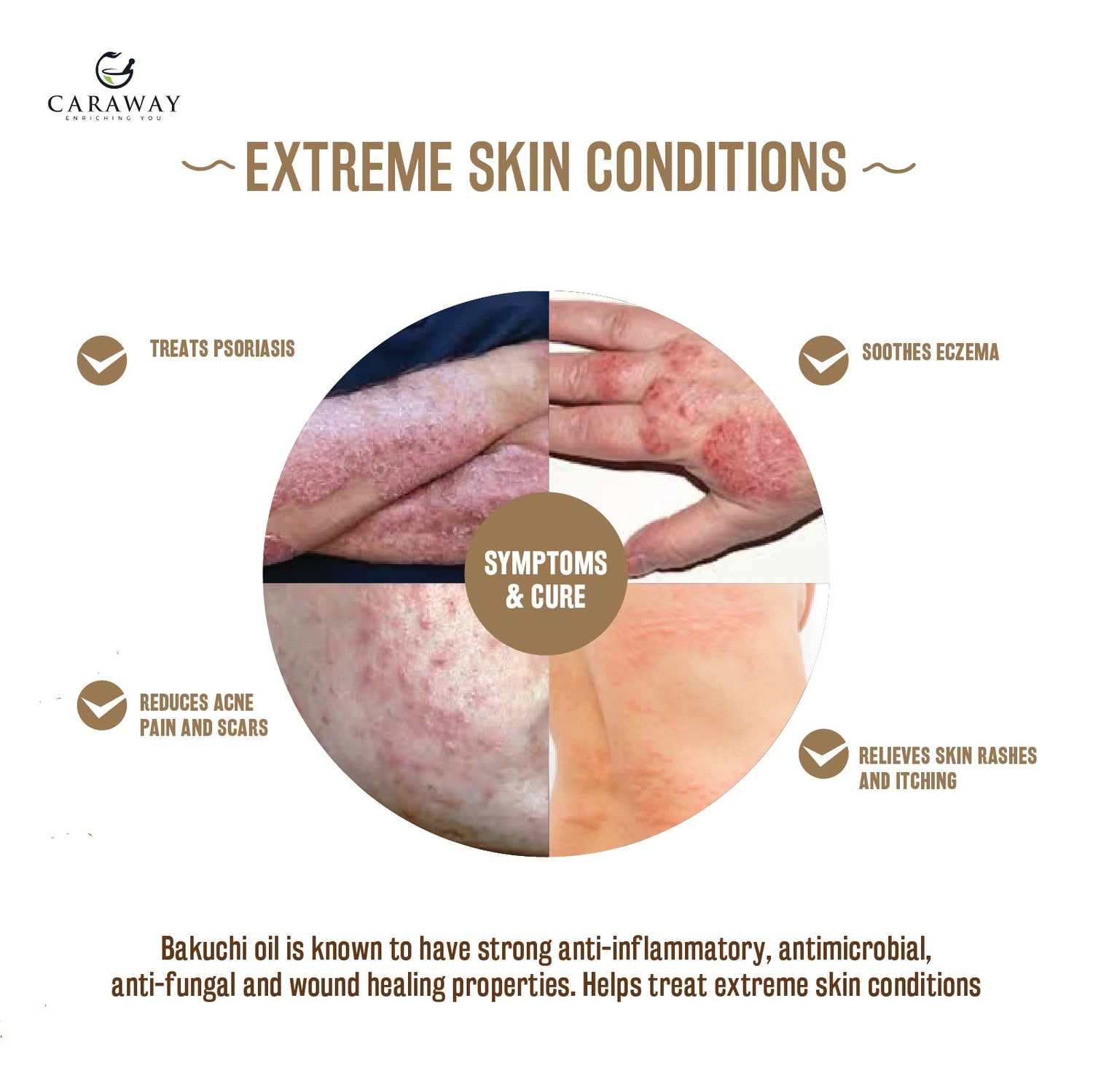 Bakuchi - Babchi Oil - Caraway