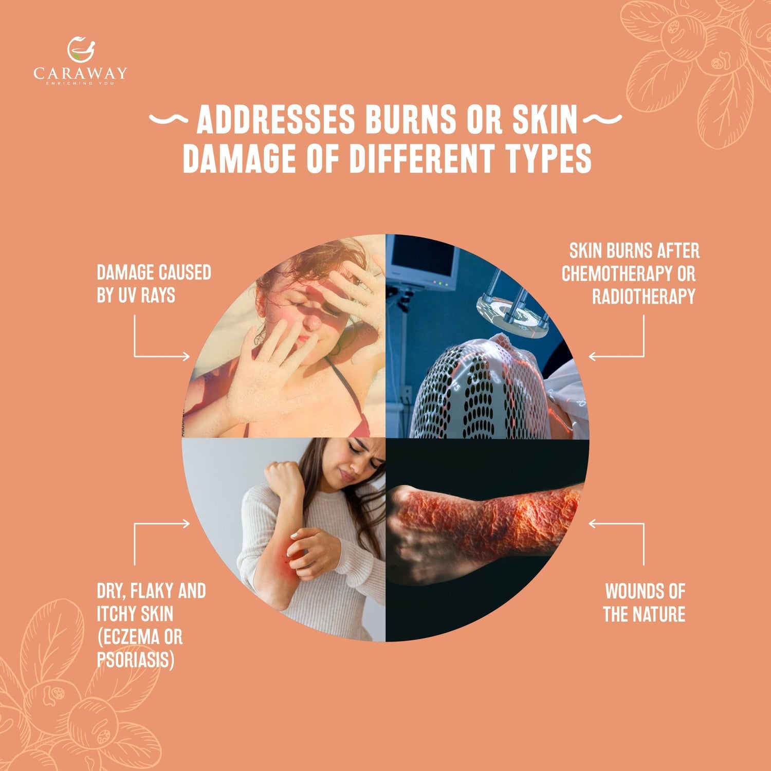 SEA BUCKTHORN WHOLE BERRY OIL - Caraway