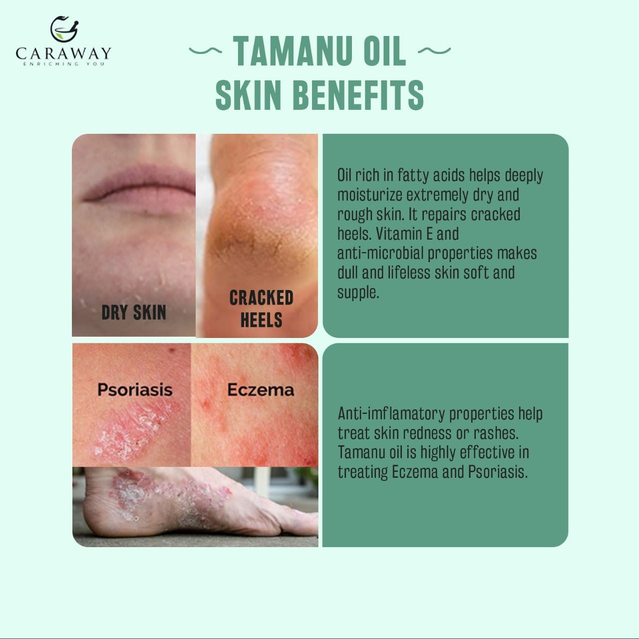 Tamanu Oil - Caraway